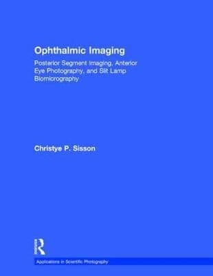 Ophthalmic Imaging: Posterior Segment Imaging, Anterior Eye Photography, and Slit Lamp Biomicrography